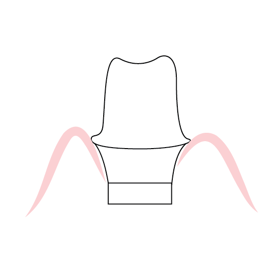 Contour Soft Tissue