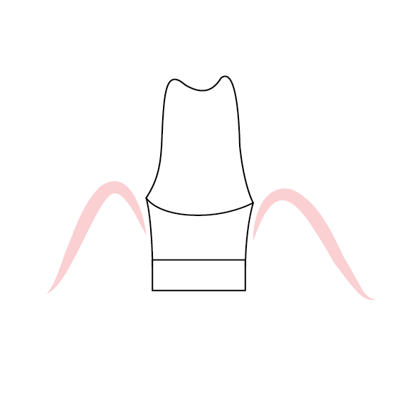 No Tissue Displacement