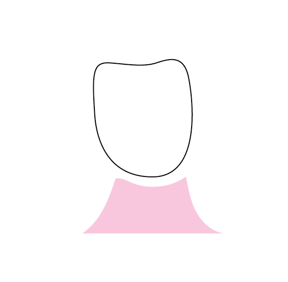 Pontic Design 2